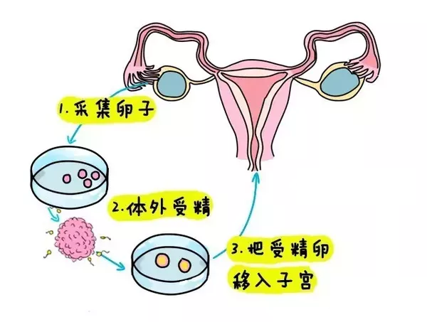 深圳试管代怀孕机构